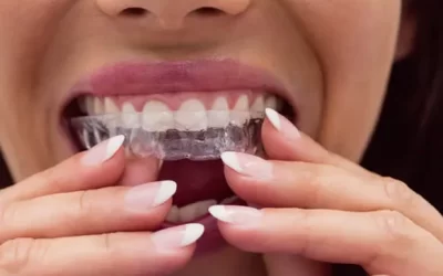 Invisalign Gardena: Clear Aligner Therapy for Discreet Orthodontic Correction